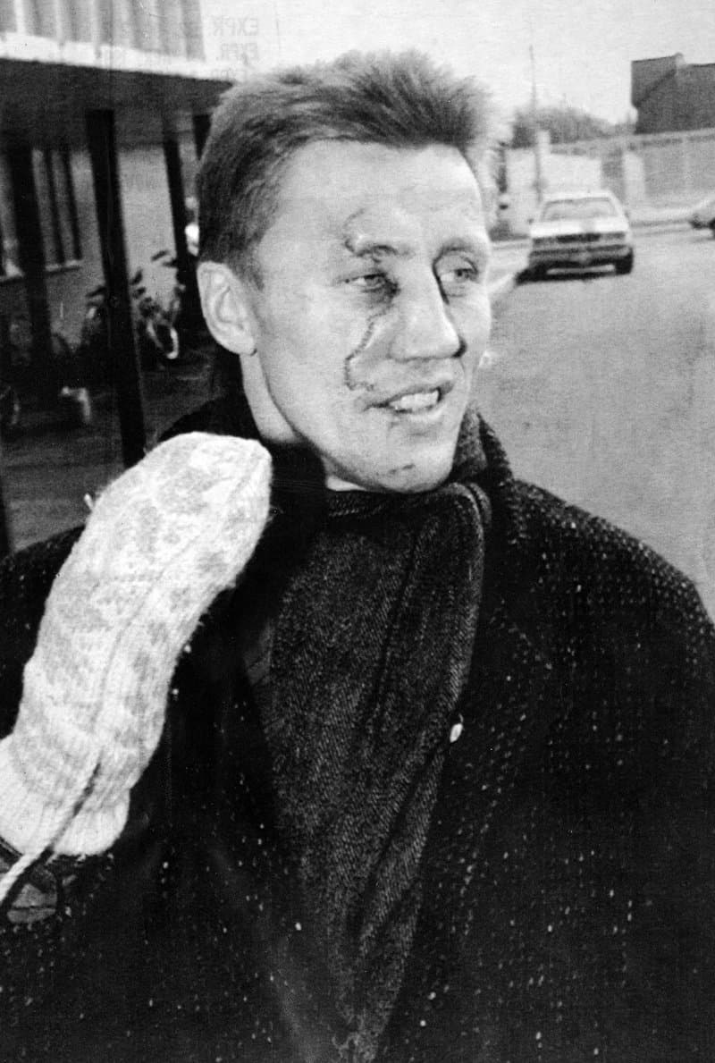 Börje Salming stygn – skadorna, operationerna och vad som hände